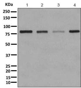 Western blot - Anti-beta glucuronidase (GUSB) antibody [EPR10616] - BSA and Azide free (AB249385), expandable thumbnail
