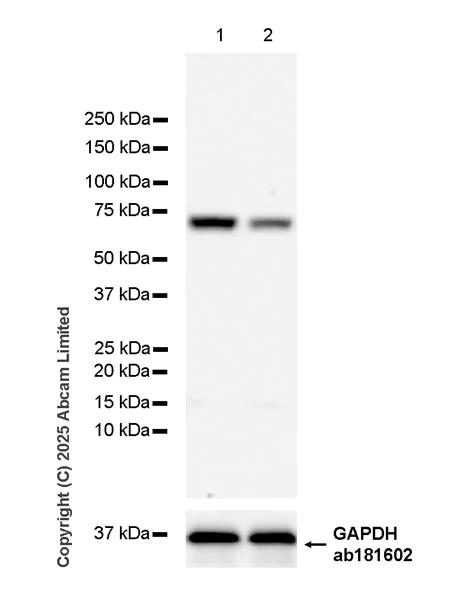 Western blot - Anti-beta glucuronidase (GUSB) antibody [EPR30359-525] (AB324344)