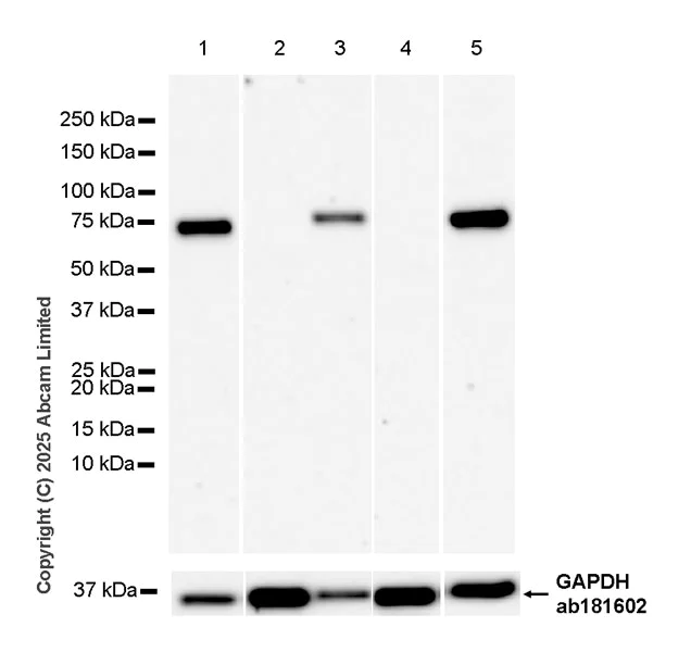 Western blot - Anti-beta glucuronidase (GUSB) antibody [EPR30359-525] (AB324344)
