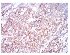 Immunohistochemistry (Formalin/PFA-fixed paraffin-embedded sections) - Anti-beta I Tubulin antibody [2A1A9] (AB204947)