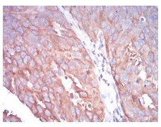 Immunohistochemistry (Formalin/PFA-fixed paraffin-embedded sections) - Anti-beta I Tubulin antibody [2A1A9] (AB204947)