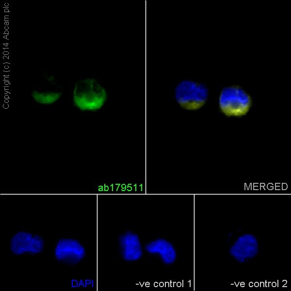 Immunocytochemistry/ Immunofluorescence - Anti-beta I Tubulin antibody [EPR16778] (ab179511), expandable thumbnail