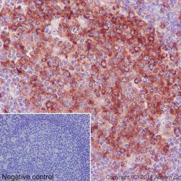 Immunohistochemistry (Formalin/PFA-fixed paraffin-embedded sections) - Anti-beta I Tubulin antibody [EPR16778] (ab179511), expandable thumbnail