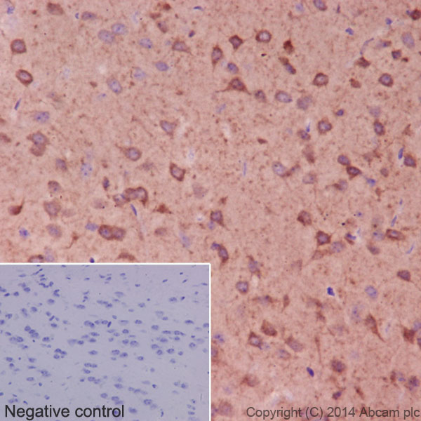 Immunohistochemistry (Formalin/PFA-fixed paraffin-embedded sections) - Anti-beta I Tubulin antibody [EPR16778] (ab179511), expandable thumbnail
