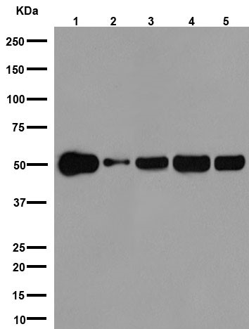 Western blot - Anti-beta I Tubulin antibody [EPR16778] (AB179511), expandable thumbnail