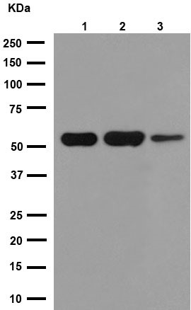 Western blot - Anti-beta I Tubulin antibody [EPR16778] (AB179511), expandable thumbnail