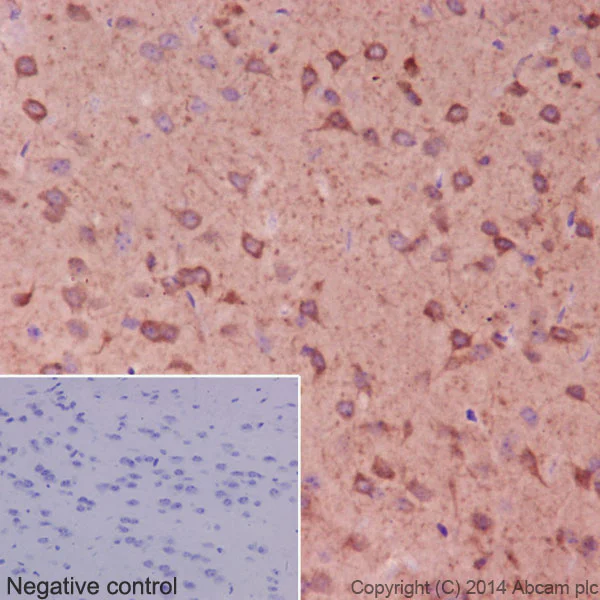 Immunohistochemistry (Formalin/PFA-fixed paraffin-embedded sections) - Anti-beta I Tubulin antibody [EPR16778] - BSA and Azide free (AB250104)