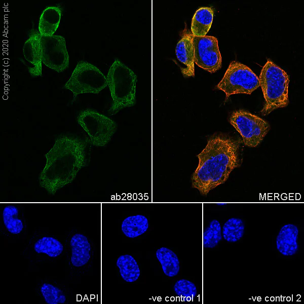 Immunocytochemistry/ Immunofluorescence - Anti-beta II Tubulin antibody [7B9] (AB28035)