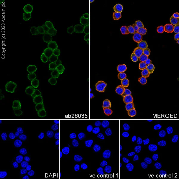 Immunocytochemistry/ Immunofluorescence - Anti-beta II Tubulin antibody [7B9] (AB28035)