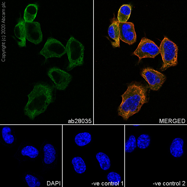 Immunocytochemistry/ Immunofluorescence - Anti-beta II Tubulin antibody [7B9] - BSA and Azide free (ab255982), expandable thumbnail