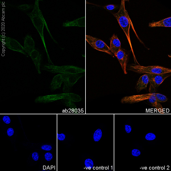Immunocytochemistry/ Immunofluorescence - Anti-beta II Tubulin antibody [7B9] - BSA and Azide free (AB255982), expandable thumbnail