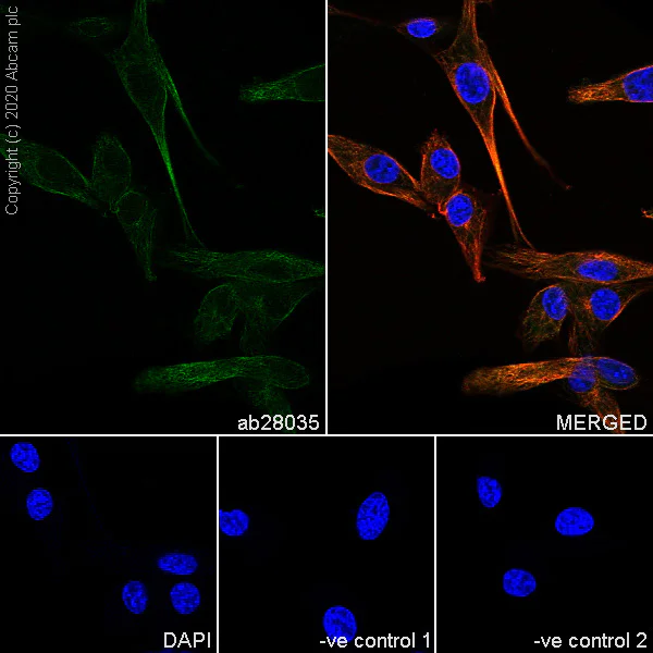 Immunocytochemistry/ Immunofluorescence - Anti-beta II Tubulin antibody [7B9] - BSA and Azide free (AB255982)