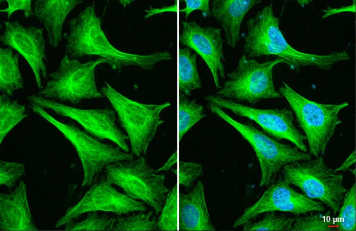 Immunocytochemistry/ Immunofluorescence - Anti-beta II Tubulin antibody (AB151318)