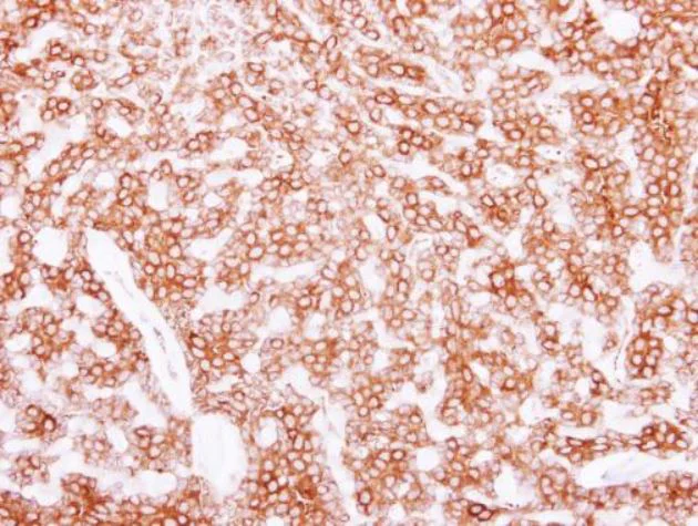 Immunohistochemistry (Formalin/PFA-fixed paraffin-embedded sections) - Anti-beta II Tubulin antibody (AB151318)