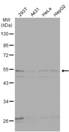Western blot - Anti-beta II Tubulin antibody (AB151318)