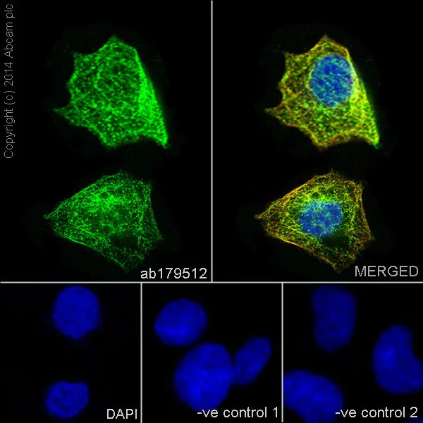 Immunocytochemistry/ Immunofluorescence - Anti-beta II Tubulin antibody [EPR16773] (AB179512)