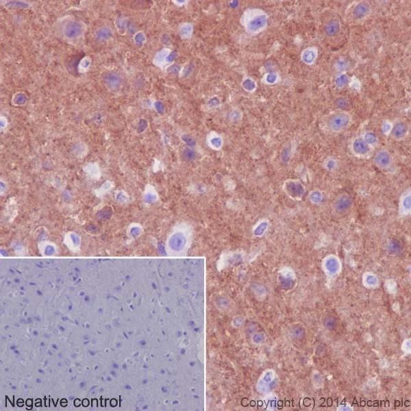 Immunohistochemistry (Formalin/PFA-fixed paraffin-embedded sections) - Anti-beta II Tubulin antibody [EPR16773] - BSA and Azide free (AB250105)
