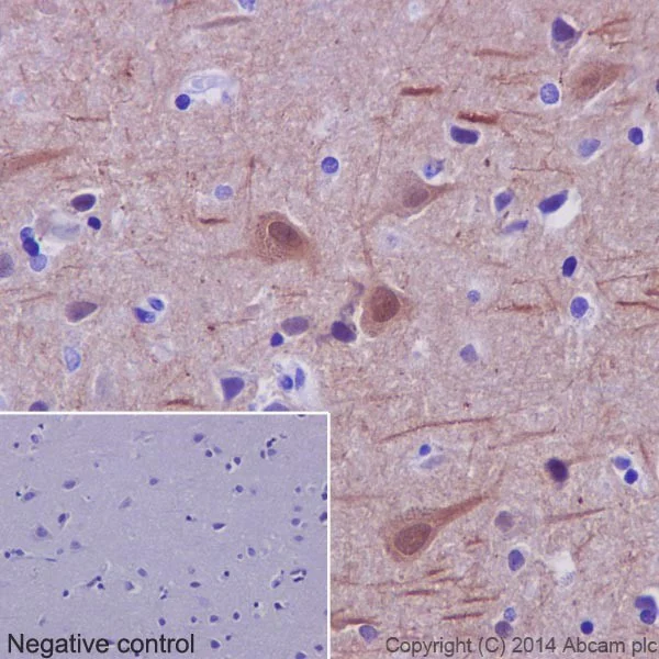 Immunohistochemistry (Formalin/PFA-fixed paraffin-embedded sections) - Anti-beta II Tubulin antibody [EPR16773] - BSA and Azide free (AB250105)