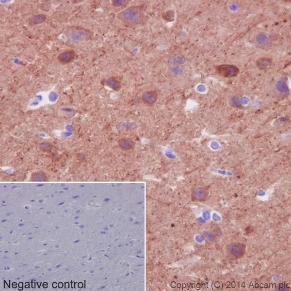 Immunohistochemistry (Formalin/PFA-fixed paraffin-embedded sections) - Anti-beta II Tubulin antibody [EPR16773] - BSA and Azide free (AB250105)