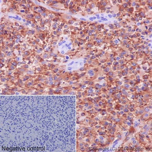Immunohistochemistry (Formalin/PFA-fixed paraffin-embedded sections) - Anti-beta II Tubulin antibody [EPR16773] - BSA and Azide free (AB250105)