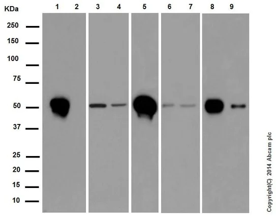 Western blot - Anti-beta II Tubulin antibody [EPR16773] - BSA and Azide free (AB250105)