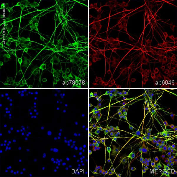 Immunocytochemistry/ Immunofluorescence - Anti-beta III Tubulin antibody [2G10] - BSA and Azide free (AB264097)