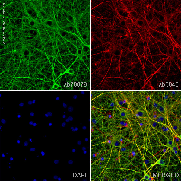 Immunocytochemistry/ Immunofluorescence - Anti-beta III Tubulin antibody [2G10] - BSA and Azide free (ab264097), expandable thumbnail