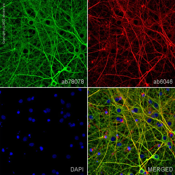 Immunocytochemistry/ Immunofluorescence - Anti-beta III Tubulin antibody [2G10] - BSA and Azide free (AB264097)