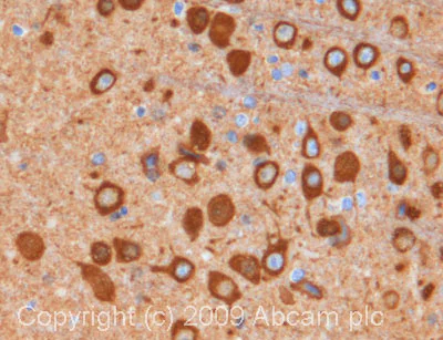 Immunohistochemistry (Formalin/PFA-fixed paraffin-embedded sections) - Anti-beta III Tubulin antibody [2G10] - BSA and Azide free (AB264097)