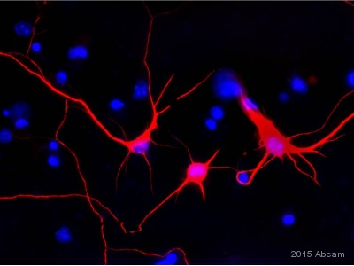 Immunocytochemistry/ Immunofluorescence - Anti-beta III Tubulin antibody [2G10] - Neuronal Marker (ab78078), expandable thumbnail