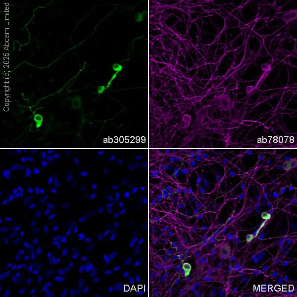 Immunocytochemistry/ Immunofluorescence - Anti-beta III Tubulin antibody [2G10] - Neuronal Marker (AB78078)