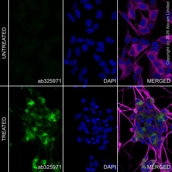 Immunocytochemistry/ Immunofluorescence - Anti-beta III Tubulin antibody [2G10] - Neuronal Marker (AB78078)