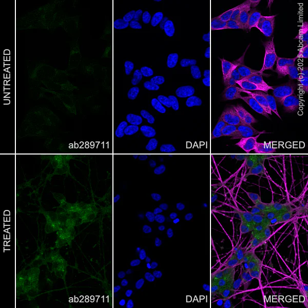 Immunocytochemistry/ Immunofluorescence - Anti-beta III Tubulin antibody [2G10] - Neuronal Marker (AB78078)