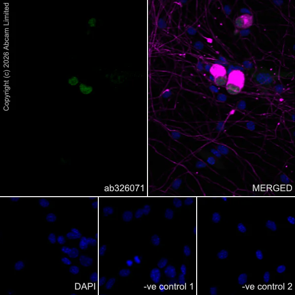 Immunocytochemistry/ Immunofluorescence - Anti-beta III Tubulin antibody [2G10] - Neuronal Marker (AB78078)