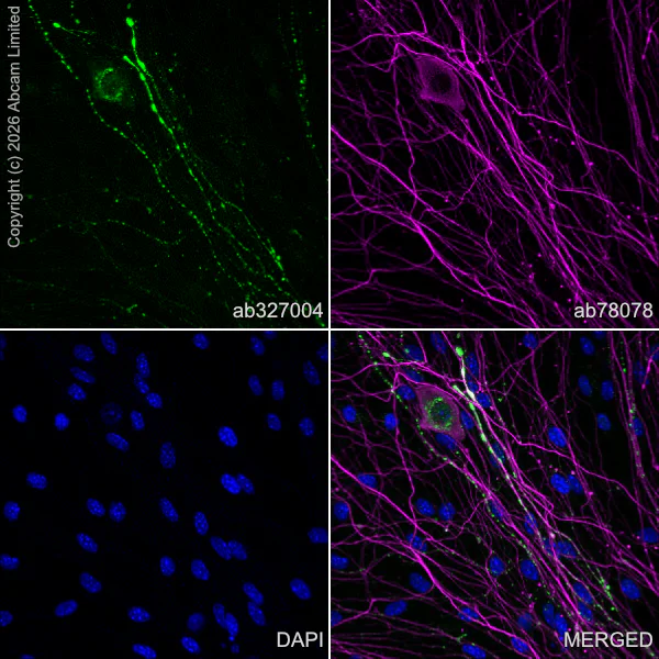 Immunocytochemistry/ Immunofluorescence - Anti-beta III Tubulin antibody [2G10] - Neuronal Marker (AB78078)