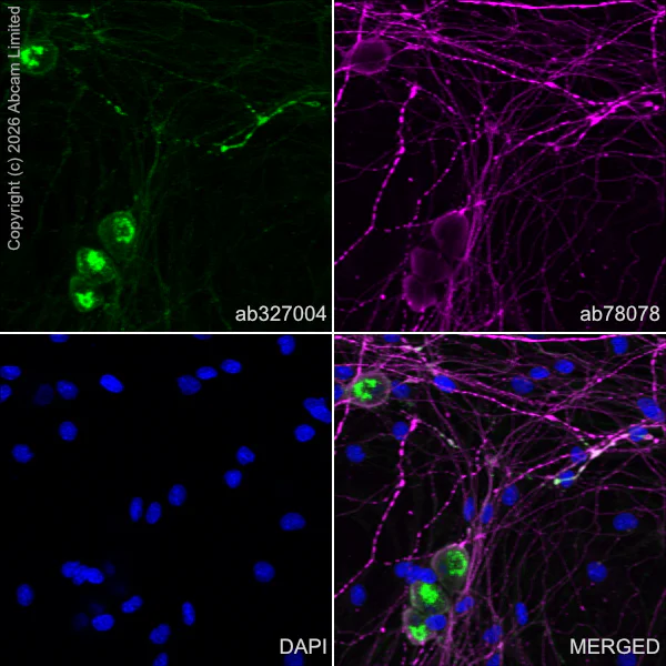 Immunocytochemistry/ Immunofluorescence - Anti-beta III Tubulin antibody [2G10] - Neuronal Marker (AB78078)