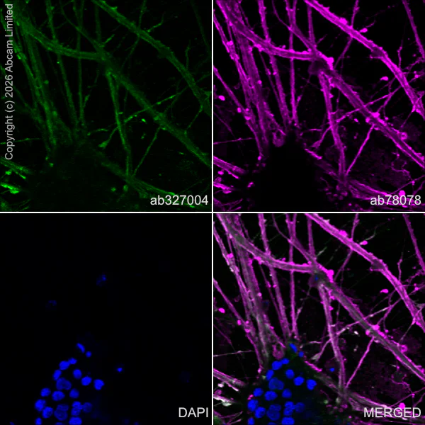 Immunocytochemistry/ Immunofluorescence - Anti-beta III Tubulin antibody [2G10] - Neuronal Marker (AB78078)