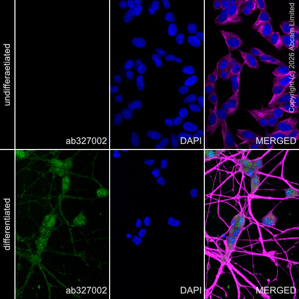 Immunocytochemistry/ Immunofluorescence - Anti-beta III Tubulin antibody [2G10] - Neuronal Marker (AB78078)