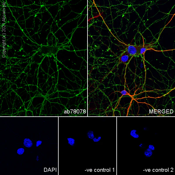 Immunocytochemistry/ Immunofluorescence - Anti-beta III Tubulin antibody [2G10] - Neuronal Marker (AB78078)