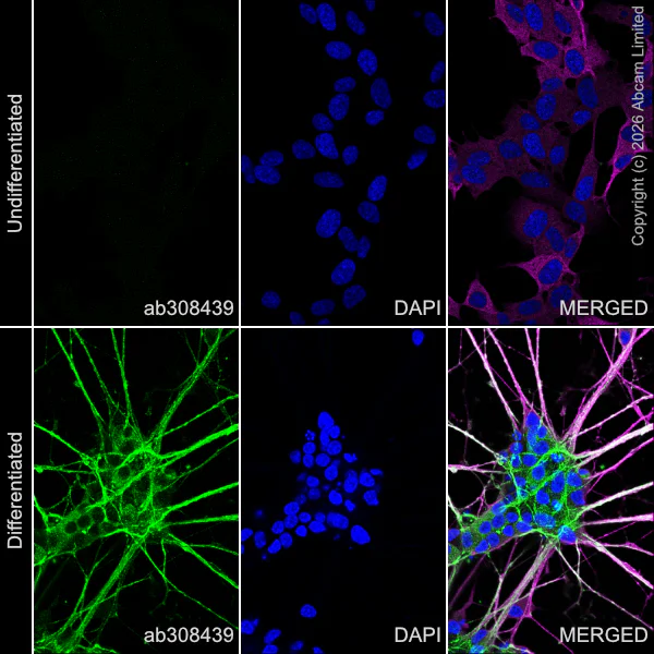 Immunocytochemistry/ Immunofluorescence - Anti-beta III Tubulin antibody [2G10] - Neuronal Marker (AB78078)