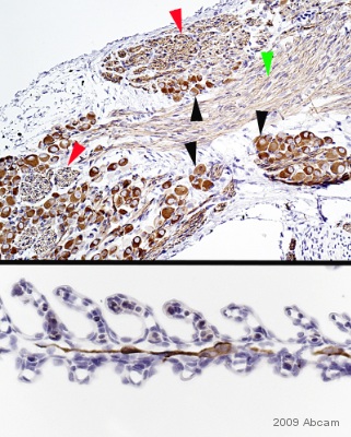 Immunohistochemistry (Formalin/PFA-fixed paraffin-embedded sections) - Anti-beta III Tubulin antibody [2G10] - Neuronal Marker (ab78078), expandable thumbnail