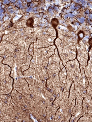 Immunohistochemistry (Formalin/PFA-fixed paraffin-embedded sections) - Anti-beta III Tubulin antibody [2G10] - Neuronal Marker (ab78078), expandable thumbnail