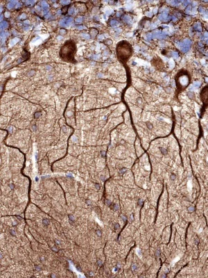 Immunohistochemistry (Formalin/PFA-fixed paraffin-embedded sections) - Anti-beta III Tubulin antibody [2G10] - Neuronal Marker (AB78078)