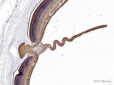 Immunohistochemistry (Formalin/PFA-fixed paraffin-embedded sections) - Anti-beta III Tubulin antibody [2G10] - Neuronal Marker (AB78078), expandable thumbnail