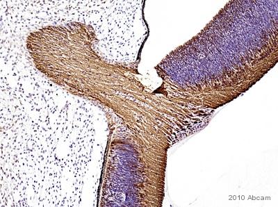 Immunohistochemistry (Formalin/PFA-fixed paraffin-embedded sections) - Anti-beta III Tubulin antibody [2G10] - Neuronal Marker (ab78078), expandable thumbnail