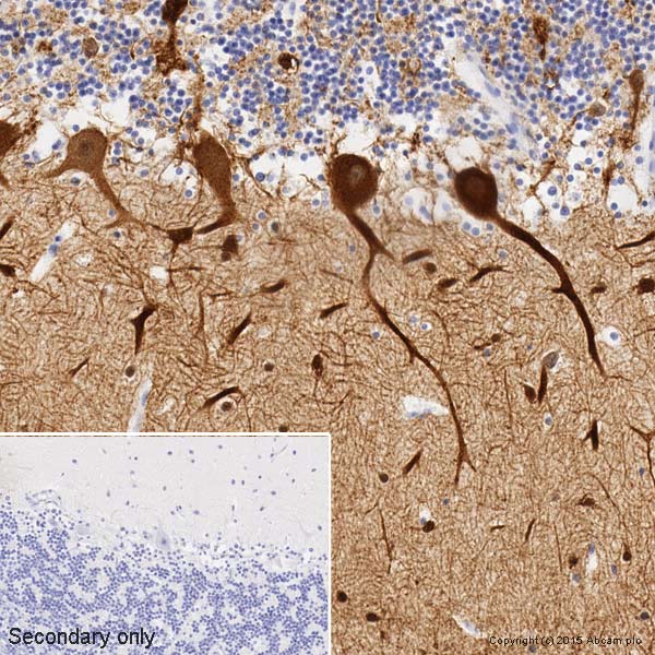Immunohistochemistry (Formalin/PFA-fixed paraffin-embedded sections) - Anti-beta III Tubulin antibody [2G10] - Neuronal Marker (ab78078), expandable thumbnail