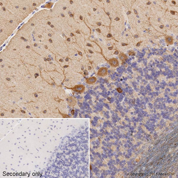 Immunohistochemistry (Formalin/PFA-fixed paraffin-embedded sections) - Anti-beta III Tubulin antibody [2G10] - Neuronal Marker (ab78078), expandable thumbnail