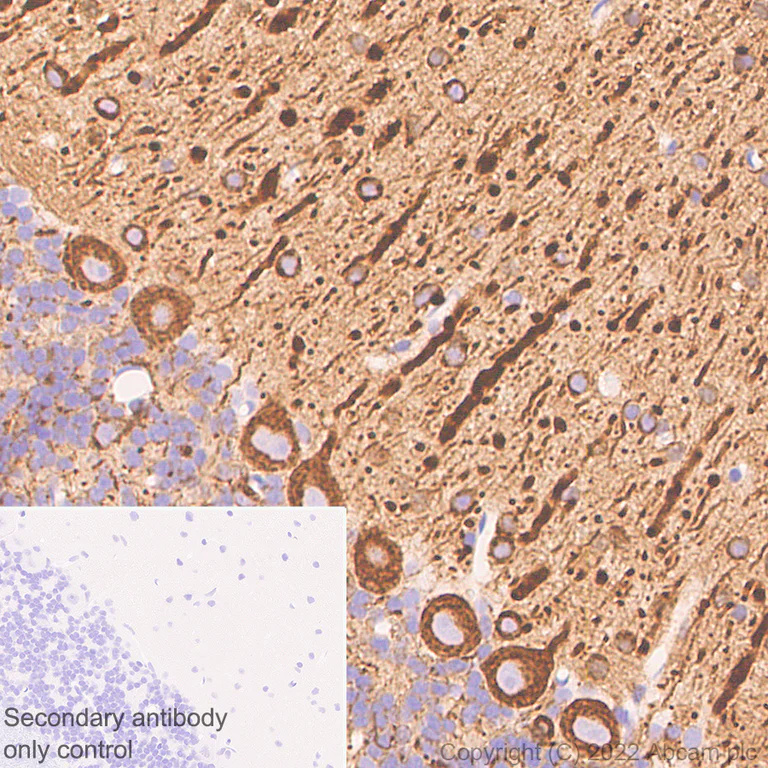 Immunohistochemistry (Formalin/PFA-fixed paraffin-embedded sections) - Anti-beta III Tubulin antibody [2G10] - Neuronal Marker (AB78078)