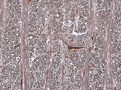 PepMix EBV (BARF1) Overlapping Peptide Pool