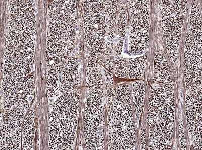 Immunohistochemistry (Formalin/PFA-fixed paraffin-embedded sections) - Anti-beta III Tubulin antibody [2G10] - Neuronal Marker (AB78078)